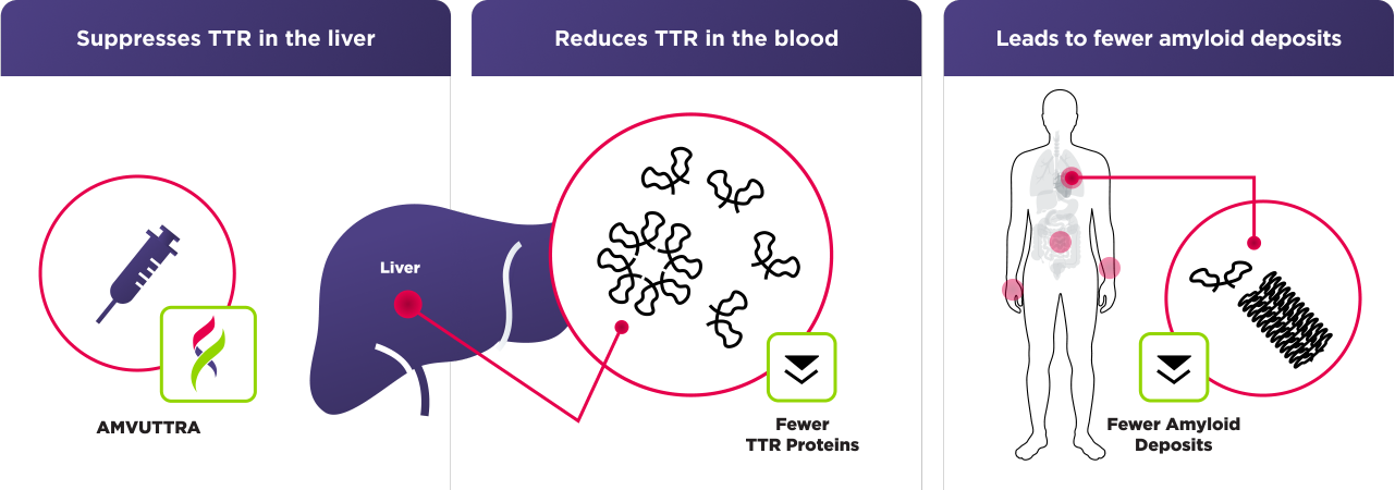 Chart showing how AMVUTTRA suppresses TTR production in the liver