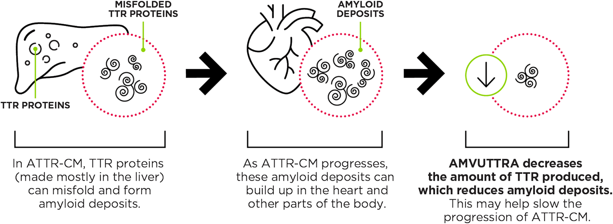 Chart showing how AMVUTTRA limits TTR production in the liver